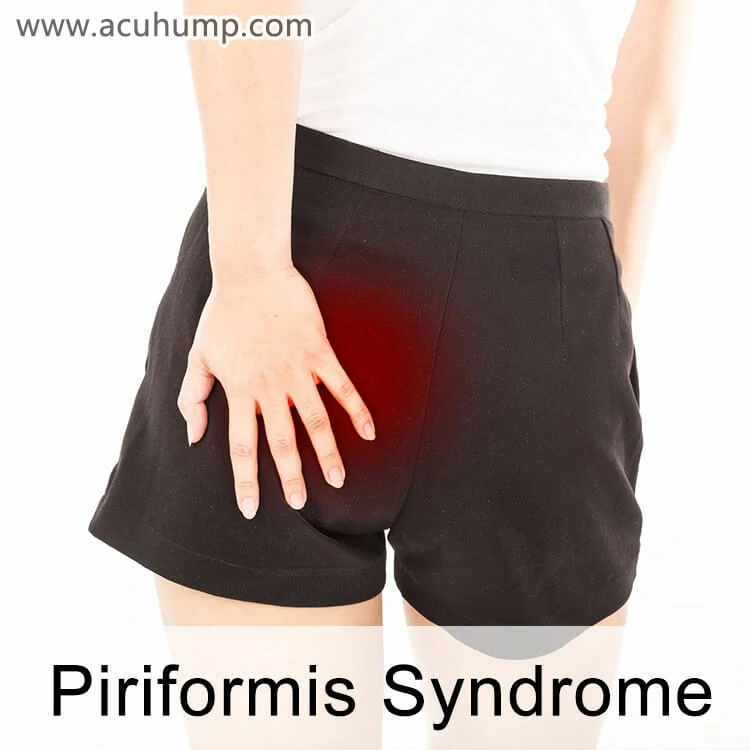 The back of a woman with her left hand touching her left buttock, piriformis pain deep in her left buttock