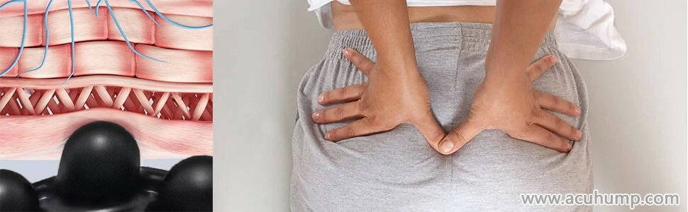 The pressure protrusion of the Acu-hump acts like a therapist's fingers, pressing on both sides of the buttock muscles to heal piriformis syndrome.