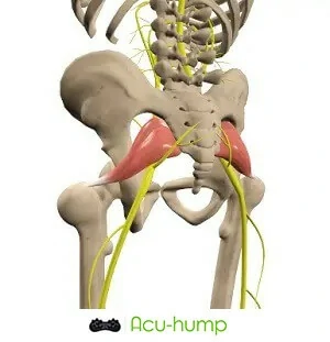 The tense and spasming piriformis muscle compresses the sciatic nerve, causing pain and resulting in piriformis syndrome.
