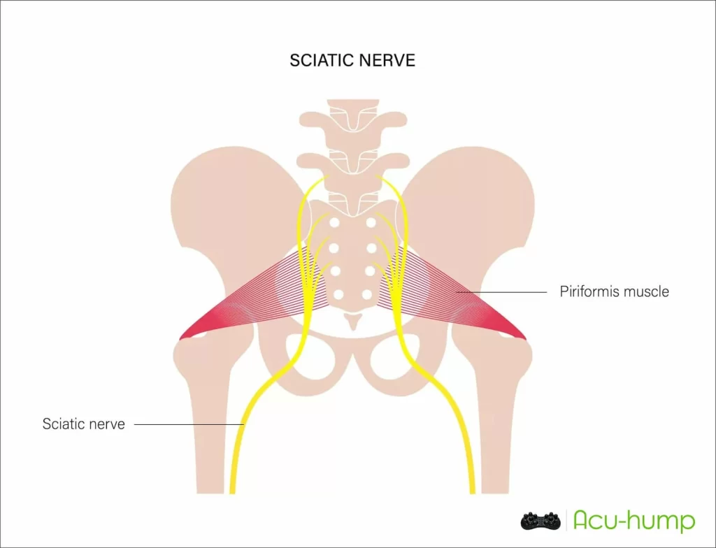 The sciatic nerve originates from the spine and passes through the deep buttock muscles