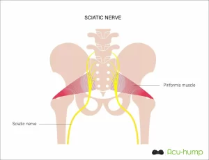 piriformis compresses sciatic nerve
