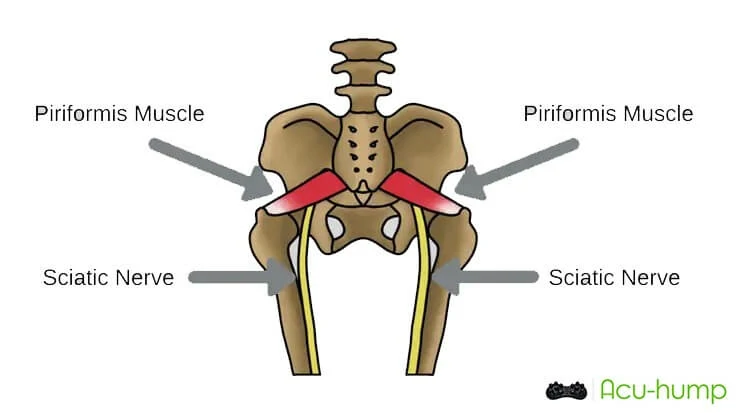 piriformis muscle and sciatic nerve