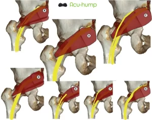 Various piriformis and sciatic nerve relationships