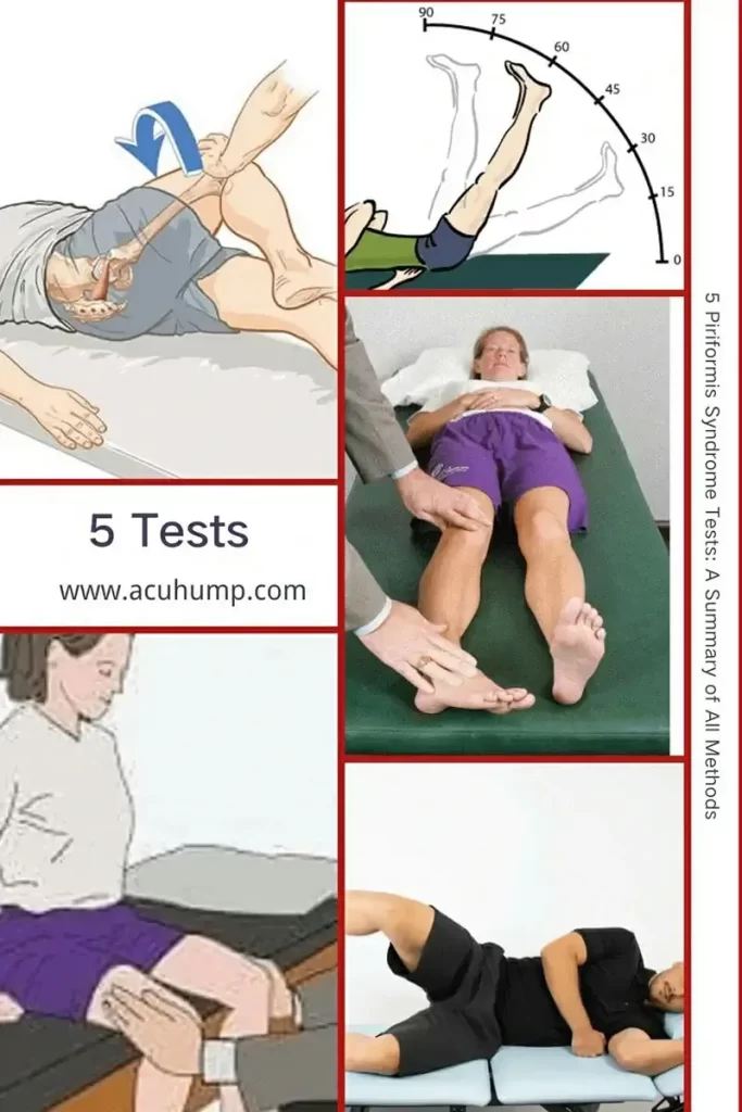 5 Piriformis Syndrome Tests: The Straight Leg Raise Self Test, Beatty's Self Test, Pace's Test, Freiberg Test, FAIR Test