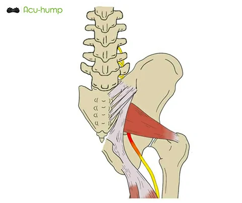 Sciatic Nerve Piriformis Syndrome Cause Groin Pain