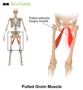 groin pain