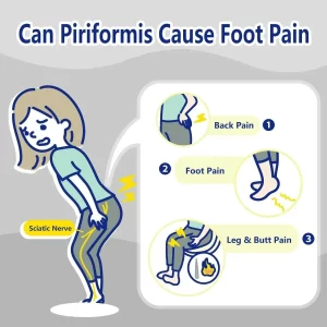 piriformis cause foot pain