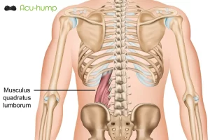 Acu-hump deep massage tightness quadratus lumborum muscle for pain relief