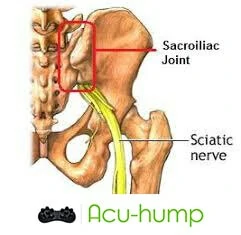 si joint and sciatic nerve