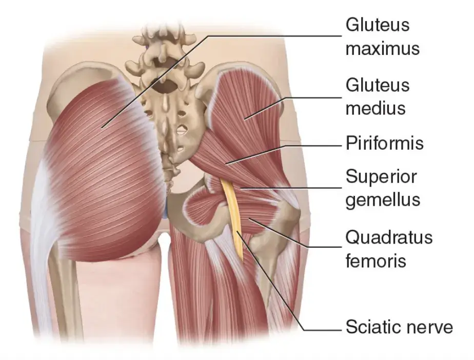 can weak glutes cause piriformis syndrome